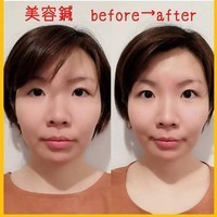 美容鍼　ご利用者様の声　高橋様