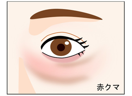 赤クマ