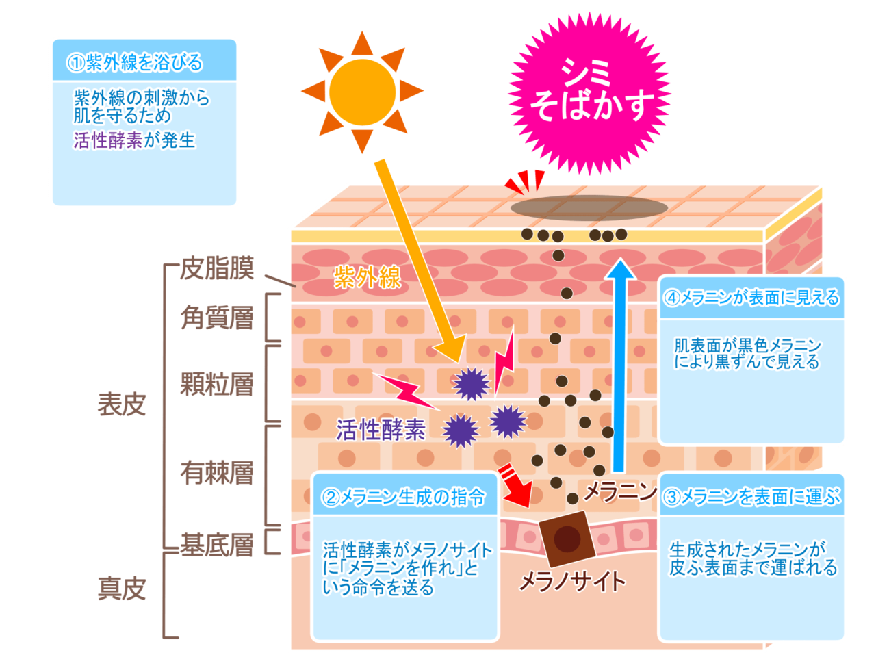 シミができる主な原因