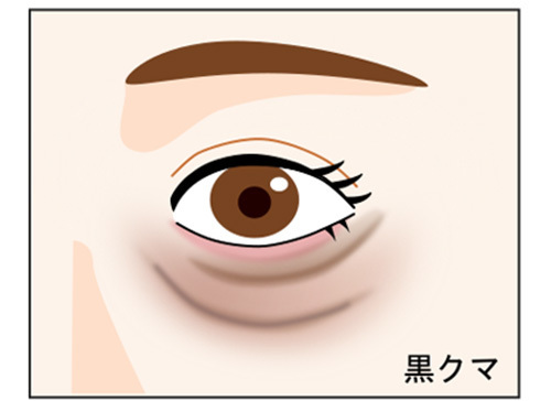 黒クマ