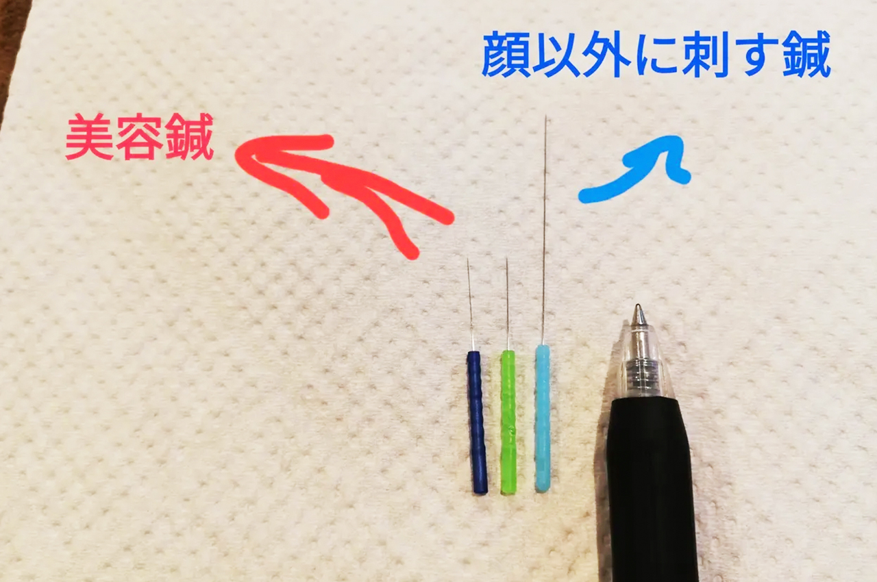 美容鍼の画像