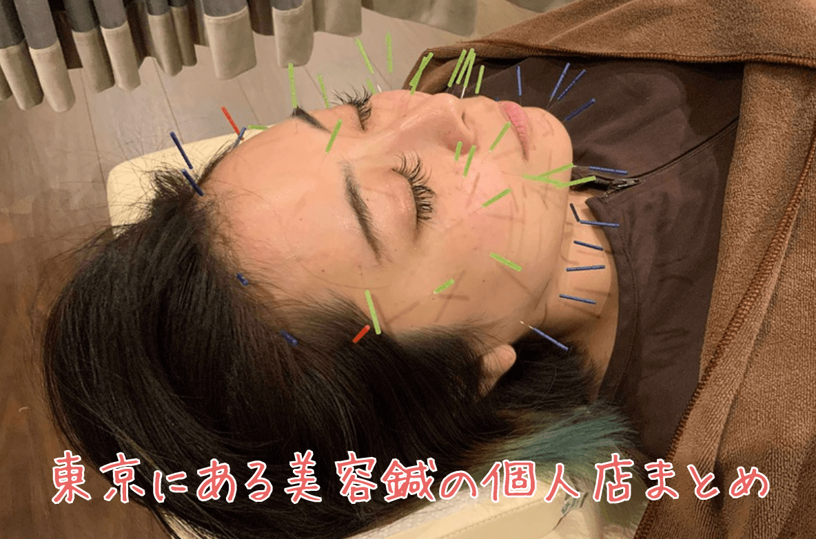 東京にある美容鍼の個人店まとめ
