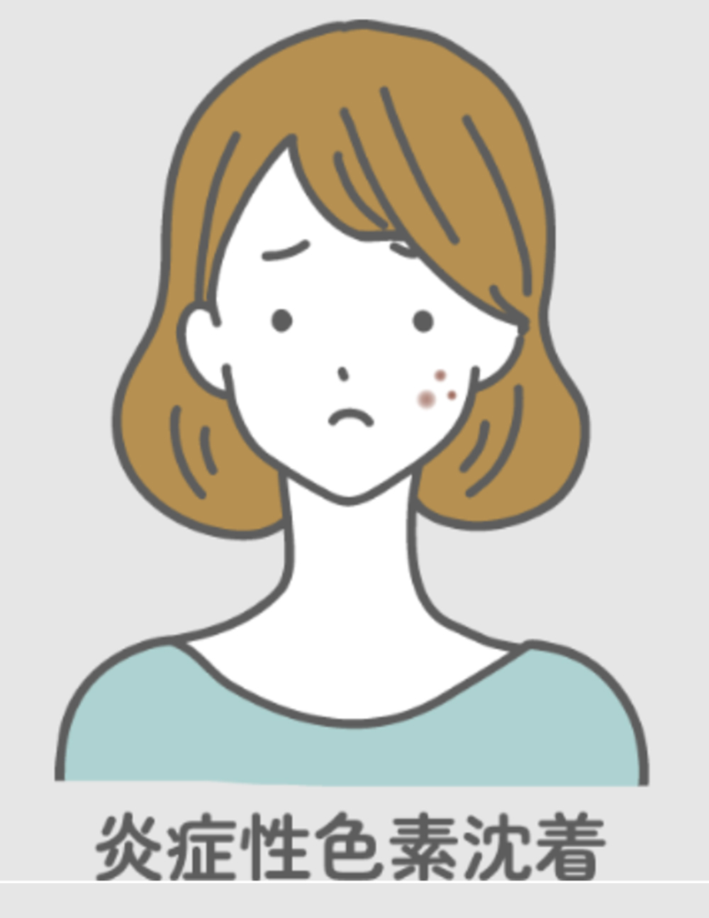 炎症後色素沈着（PIH）