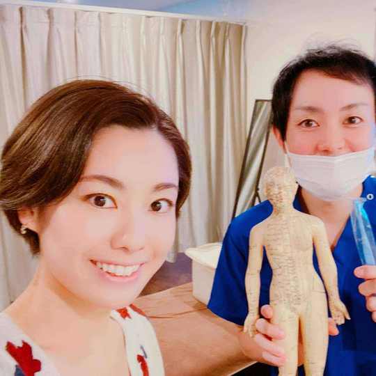 美容鍼の改善例：小川さま