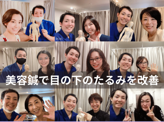 美容鍼で目の下のたるみを改善
