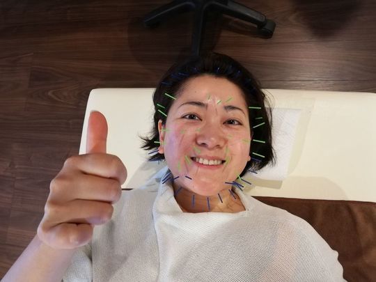美容鍼　お客様の声　にと様