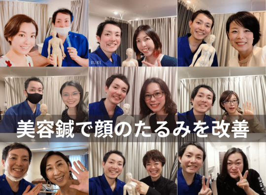 美容鍼でたるみ改善