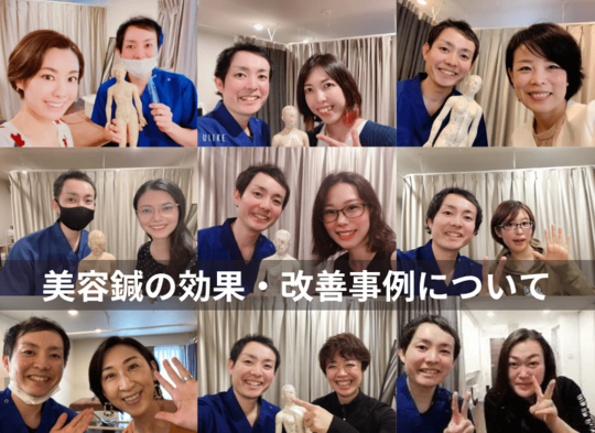 美容鍼の効果・改善例について