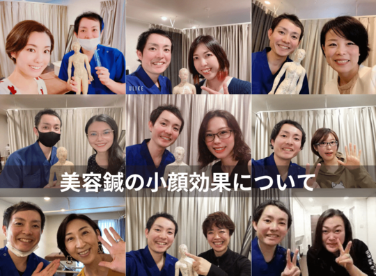 美容鍼の小顔効果について